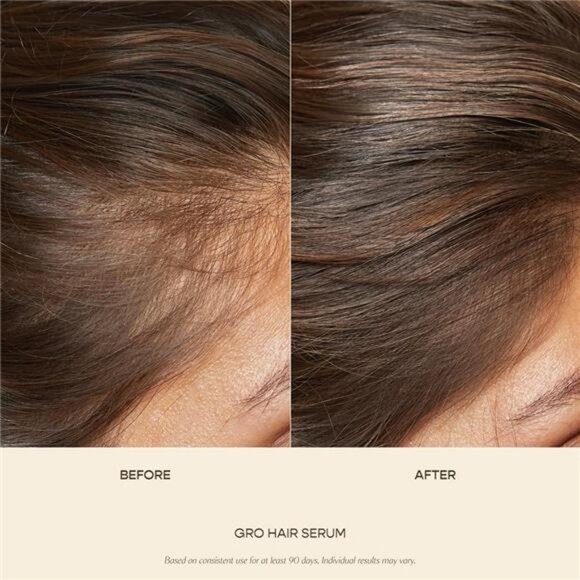 Hair Serum 3-Pack, Stock Up & Save On 3-Month Supply, Get Thicker, Fuller Hair - Picture 3 of 7